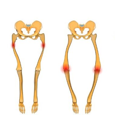 Pasmo biodrowo-piszczelowe (ITBS) u biegaczy