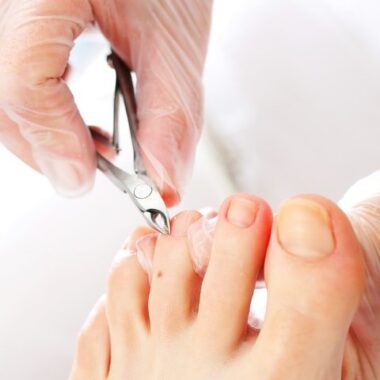 Ostroga piętowa: co w praktyce leczy ból, a co jest „tylko opisem RTG”