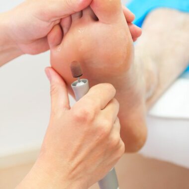 Koślawość kolan i stóp u dziecka